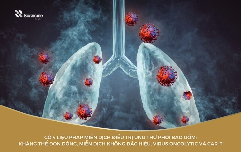 4 liệu pháp được sử dụng phổ biến trong phương pháp điều trị miễn dịch ung thư phổi