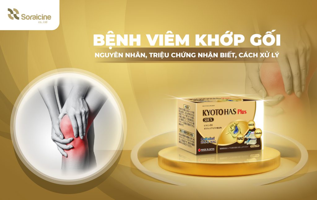 Bệnh Viêm Khớp Gối: Nguyên Nhân, Triệu Chứng Nhận Biết, Cách Xử Lý