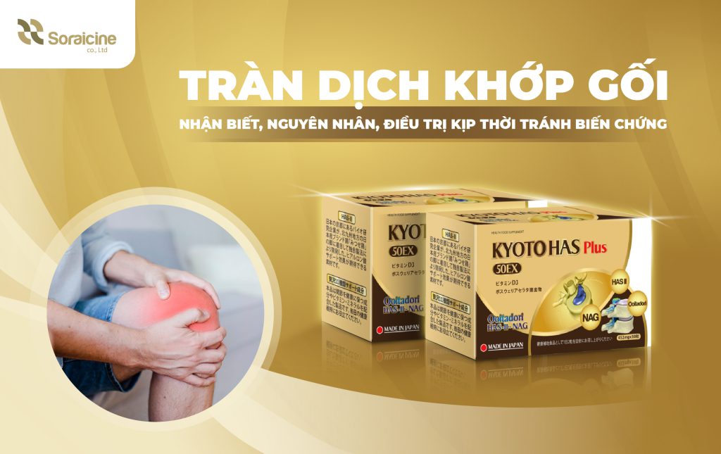 Tràn Dịch Khớp Gối: Nhận Biết, Nguyên Nhân, Điều Trị Kịp Thời Tránh Biến Chứng