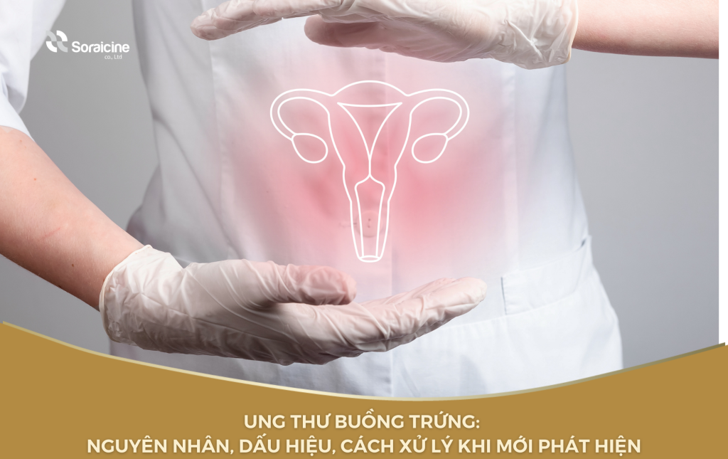 Ung thư buồng trứng là một trong những loại ung thư phổ biến nhất ở phụ nữ