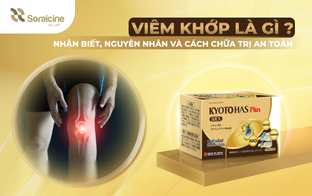 Viêm Khớp Là Gì? Nhận Biết, Nguyên Nhân Và Cách Chữa Trị An Toàn